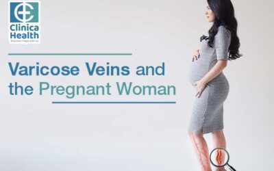 Varicose Veins and the Pregnant Woman