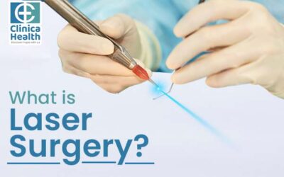 What is Laser Surgery?