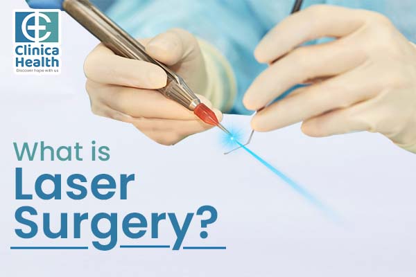 What is Laser Surgery?