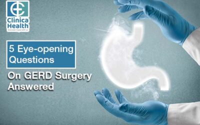 5 Eye-opening Questions On GERD Surgery Answered