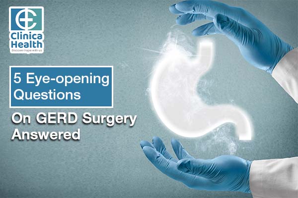 GERD Surgery