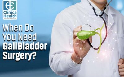 When Do You Need GallBladder Surgery?