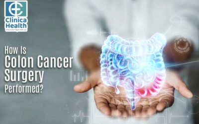 How Is Colon Cancer Surgery Performed?