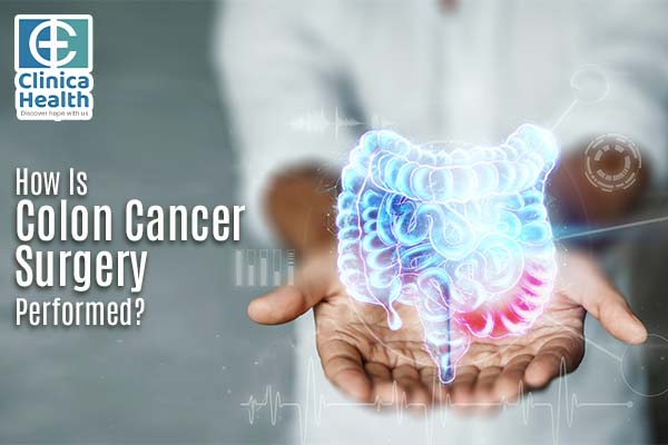 How Is Colon Cancer Surgery Performed?