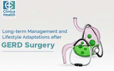 Long-term Management and Lifestyle Adaptations after GERD Surgery