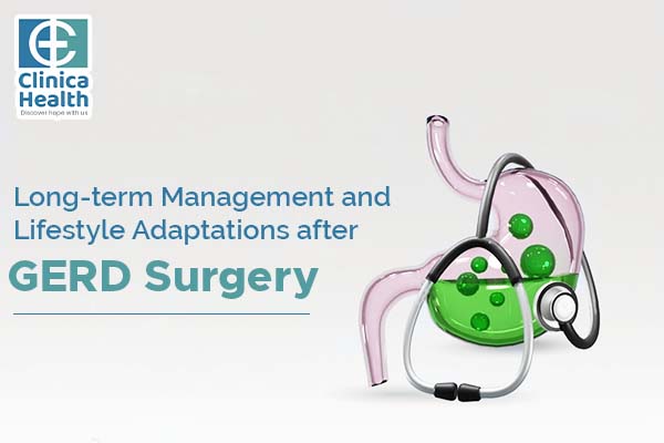 Long-term Management and Lifestyle Adaptations after GERD Surgery