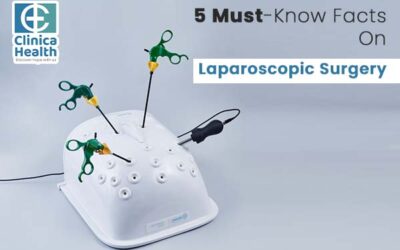 5 Must-Know Facts On Laparoscopic Surgery