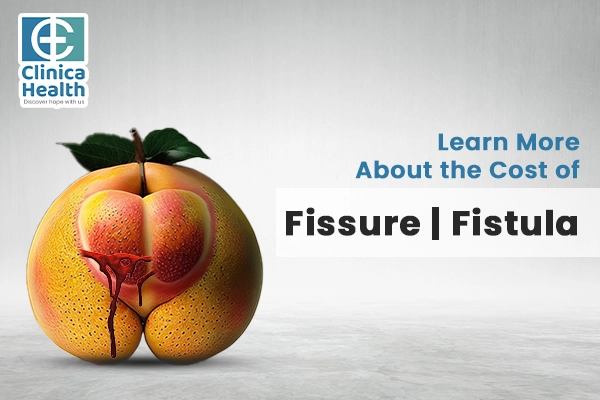 cost of fissure fistula