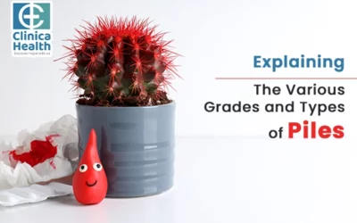 Explaining The Various Grades and Types of Piles