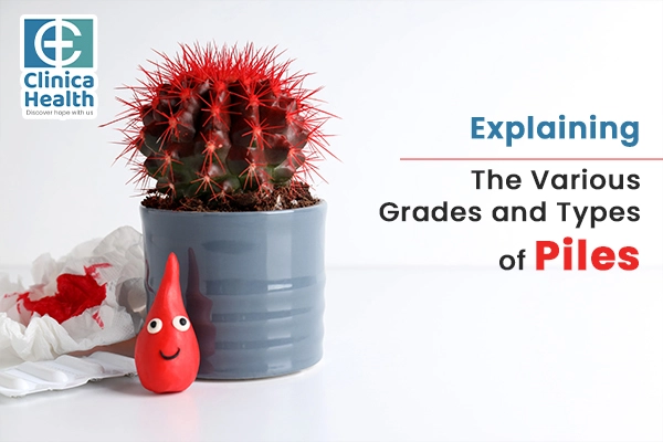 Explaining The Various Grades and Types of Piles