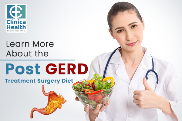 Learn More About the Post GERD Treatment Surgery Diet