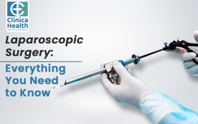 Laparoscopic Surgery: Everything You Need to Know