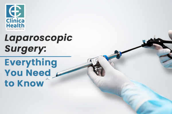 Laparoscopic surgery in Kolkata