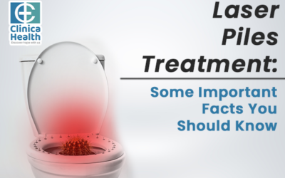 Laser Piles Treatment: Some Important Facts You Should Know