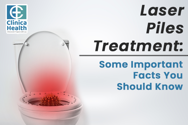 Laser Piles Treatment: Some Important Facts You Should Know