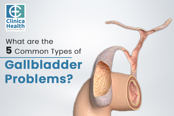 What are the 5 Common Types of Gallbladder Problems?