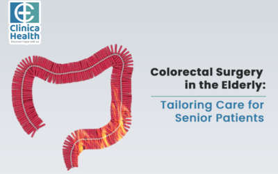 Colorectal Surgery in the Elderly: Tailoring Care for Senior Patients