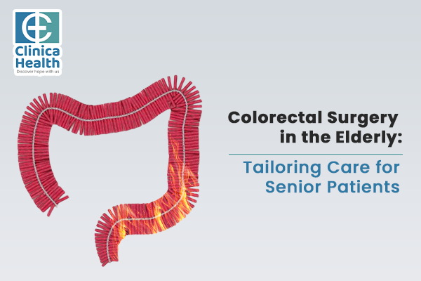 Colorectal Surgery in the Elderly: Tailoring Care for Senior Patients