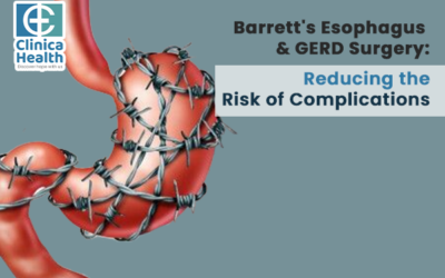 Barrett’s Esophagus and GERD Surgery: Reducing the Risk of Complications