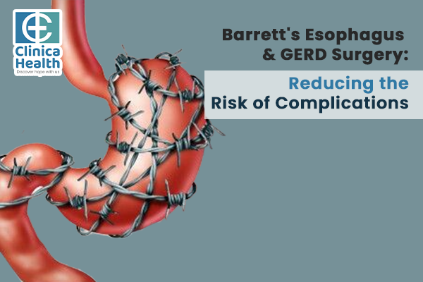 GERD treatment surgery