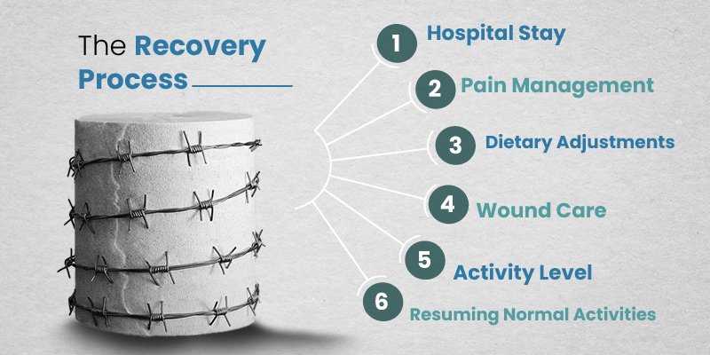 Fistula Laser Surgery Cost