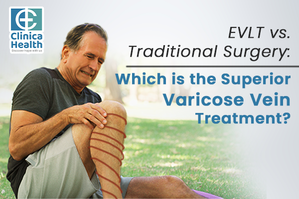 EVLT vs. Traditional Surgery: Which is the Superior Varicose Vein Treatment?