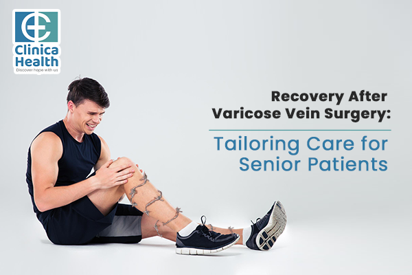 Recovery After Varicose Vein Surgery: Healing Guidance