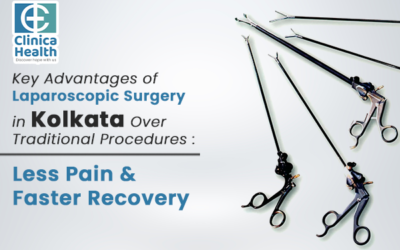 Key Advantages of Laparoscopic Surgery in Kolkata Over Traditional Procedures : Less Pain & Faster Recovery