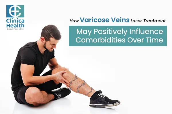 How Varicose Veins Laser Treatment May Positively Influence Comorbidities Over Time