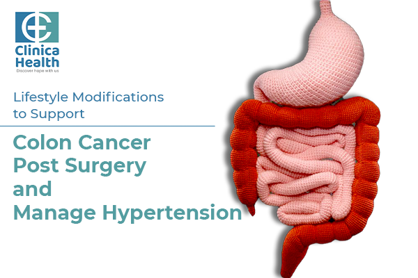 colon cancer surgery