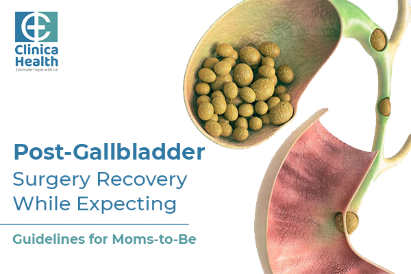 Post-Gallbladder Surgery Recovery While Expecting: Guidelines for Moms-to-Be