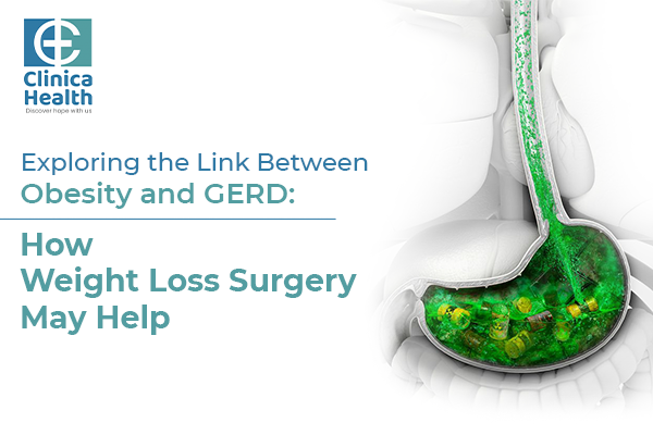 Exploring the Link Between Obesity and GERD: How Weight Loss Surgery May Help