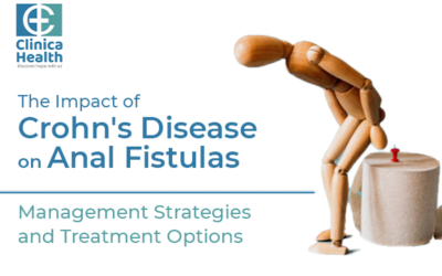 The Impact of Crohn’s Disease on Anal Fistulas: Management Strategies and Treatment Options