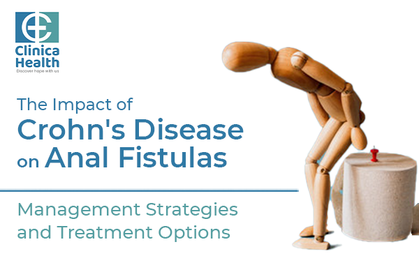 The Impact of Crohn's Disease on Anal Fistulas: Management Strategies and Treatment Options