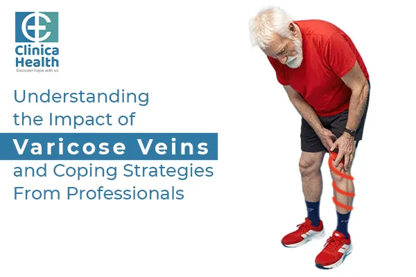 Understanding the Impact of Varicose Veins and Coping Strategies From Professionals