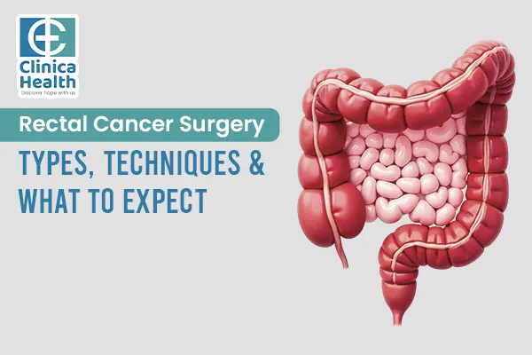 rectal cancer surgery