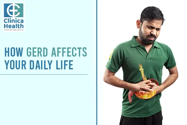 GERD Treatment