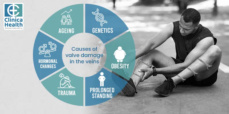 Causes of Valve Damage in the Veins