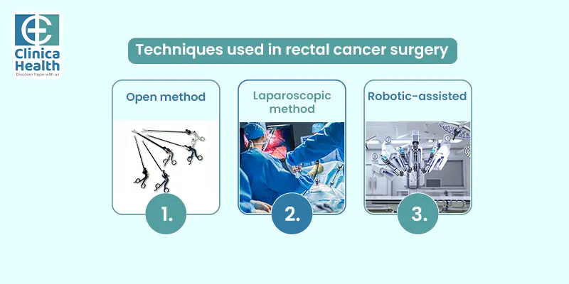 rectal cancer