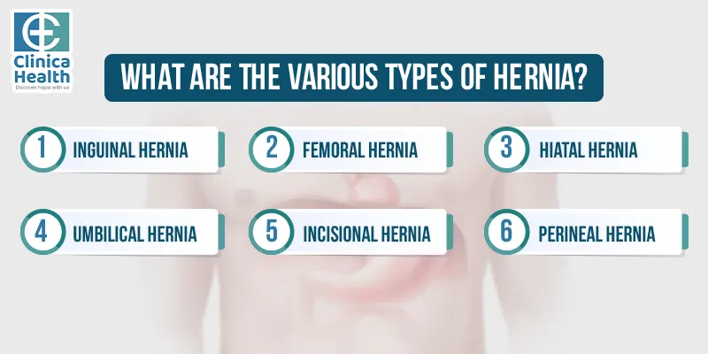 types of hernia