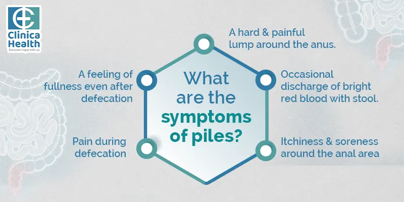 symptoms of piles