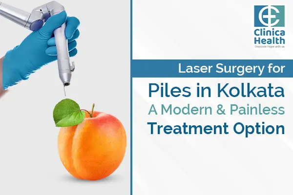 Laser Surgery for Piles