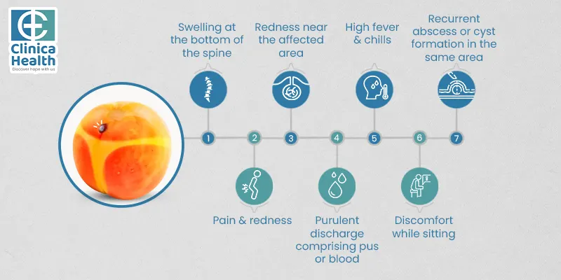 Symptoms indicating pilonidal sinus