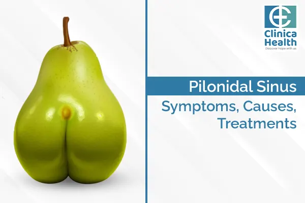 Laser Surgery for Pilonidal Sinus