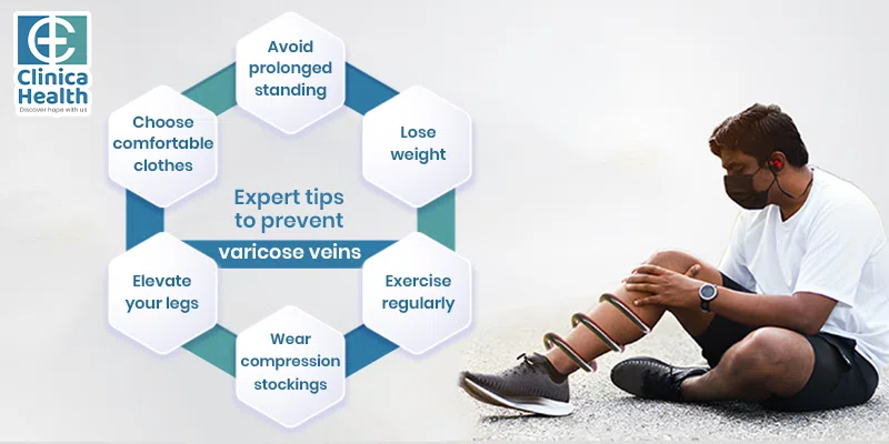 prevent varicose veins