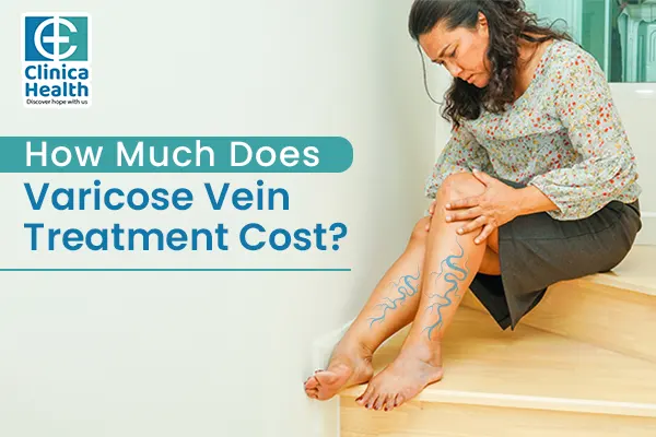 aser varicose vein surgery cost