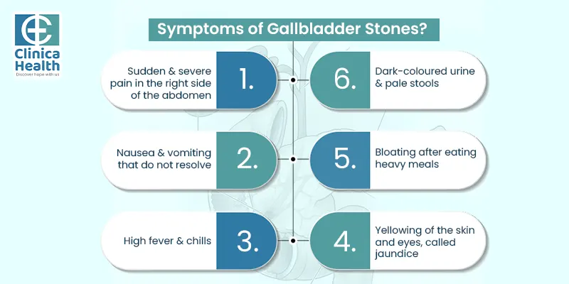 symptoms of gallbladder stones