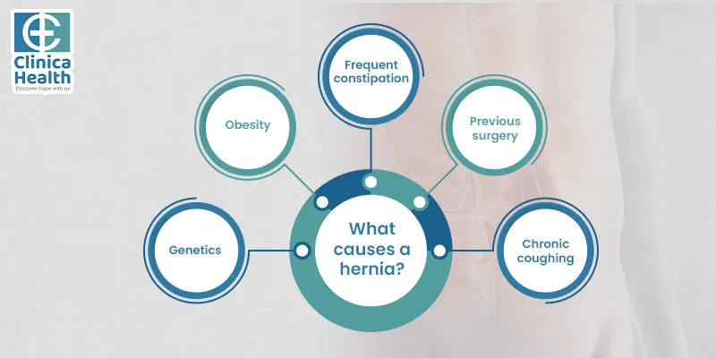 causes a hernia