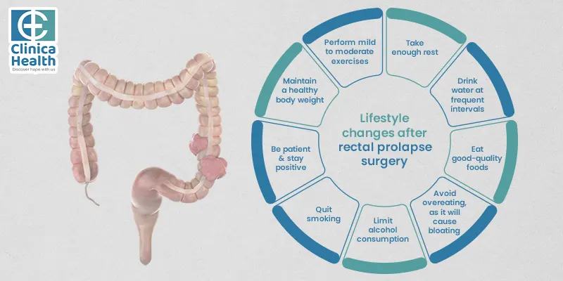 Lifestyle changes after rectal prolapse surgery