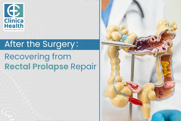 rectal prolapse surgery